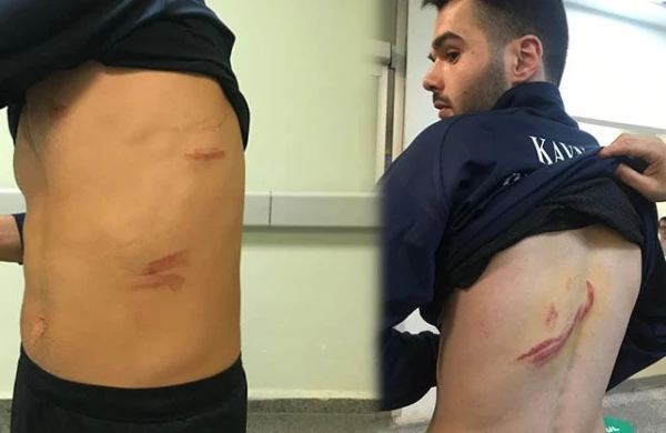 Futbolçular arasında kütləvi dava: Yaralılar var