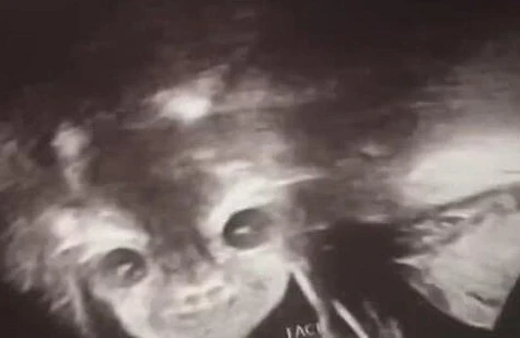 Uşağın cinsiyyətini öyrənmək üçün həkimə gedən ana həyatının şokunu yaşadı...