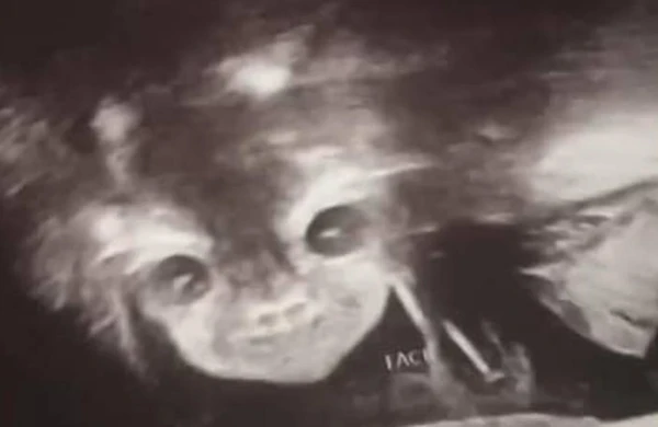 Körpəsinin cinsiyyətini öyrənmək üçün aparata girən ana ŞOKA DÜŞDÜ - Yadplanetli.../ FOTOLAR