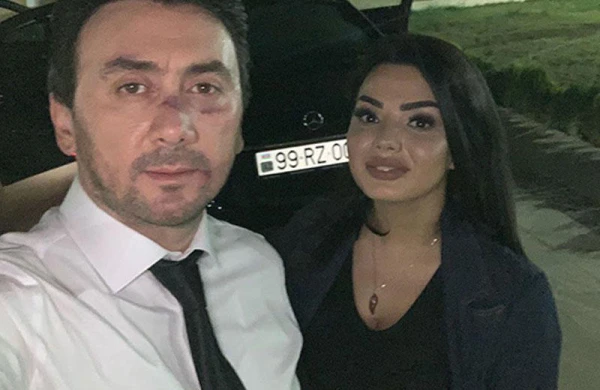 İranlılar Aqşinin 2 milyonluq klipini sildirdi - FOTO