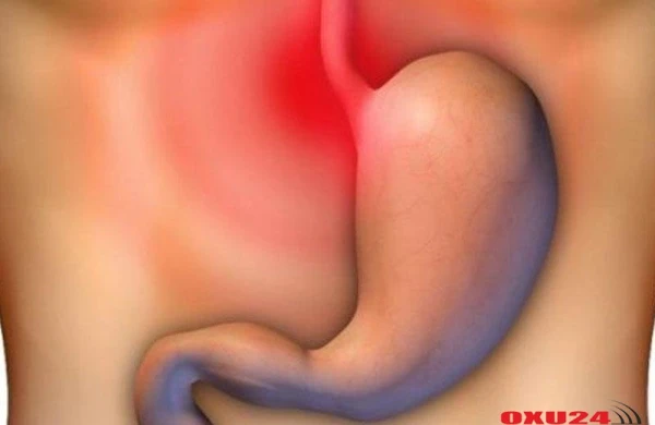 Mədənin xroniki eroziyaları