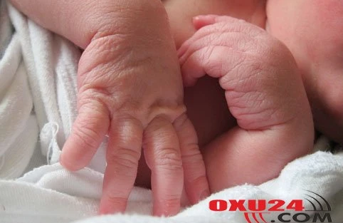 Körpələrin artıq çəkili doğulması nədən xəbər verir?