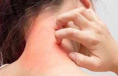 Səpkilər SİFLİS xəstəliyi ola bilər...- Həkimdən Şok AÇIQLAMA