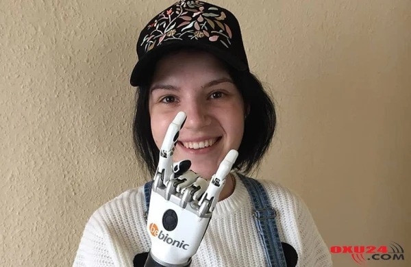 "Əllərim olmadan da xoşbəxtəm" kitabının müəllifi yenidən ailə həyatı qurur