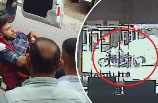 Motosiklet maşının altına girdi: Sürücünün ayağı qopdu