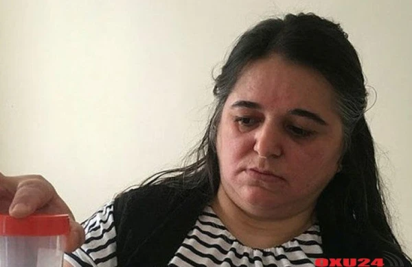 Qadının mədəsindən çıxan həkimləri şoka saldı