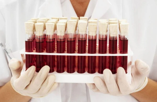 Hansı qan qrupu daha çox infarkt olur ? - ARAŞDIRMA