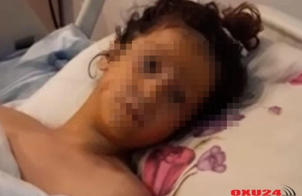 "Tok" vuran 9 yaşlı Zəhranın sol qolunu amputasiya etdilər