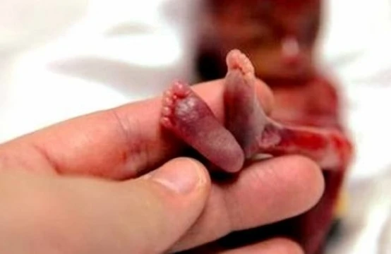 Abort necə aparılır?- Dəhşətli görüntü