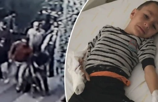 Parkda dəhşət: Pitbull uşağın qolunu parçaladı