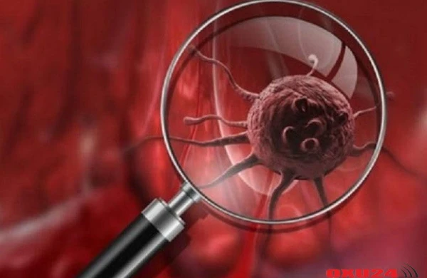 Evdəki bu əşya xərçəngə səbəb olur - ÜST xəbərdarlıq etdi