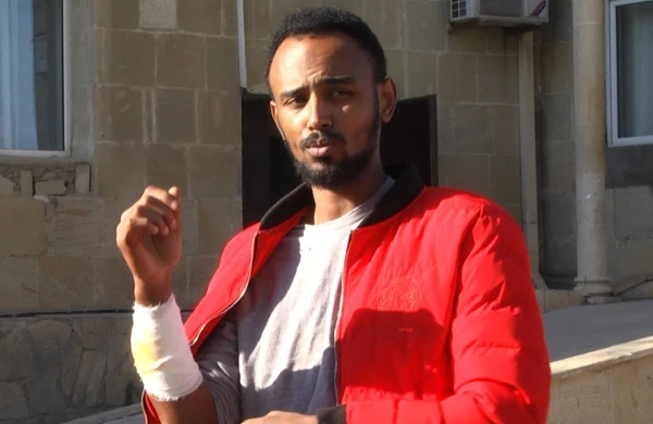 Xose Bernardo və qardaşı qıza görə bıçaqlanıb - ŞOK TƏFƏRRÜAT