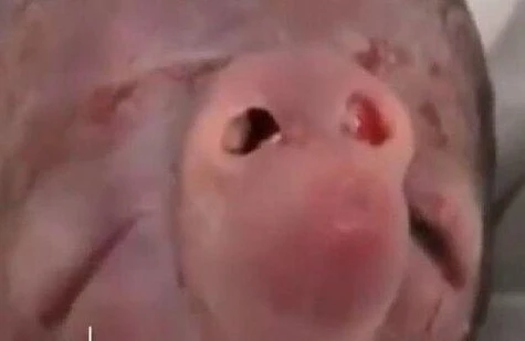 "Uşaqlar niyə qüsurlu doğulur?"-Həkim-ginekoloqdan VACİB AÇIQLAMA