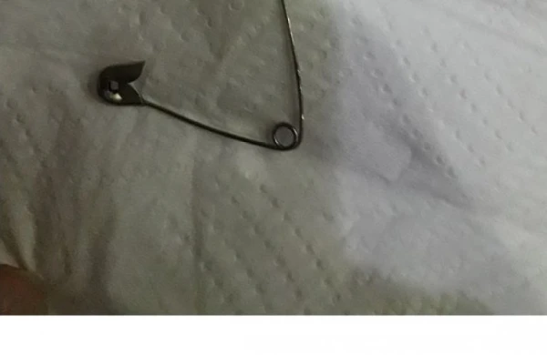 Bakıda dəhşət: qadın zavod çörəyinin içindəki sancağı uddu – “İki dövlət xəstəxanası anama kömək edə bilmədi”