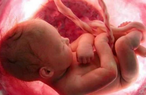 Bakıda ŞOK HADİSƏ: 14 yaşlı qız uşaq dünyaya gətirdi