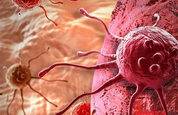 Xərçəngi yox edən yeni üsul tapılıb - ALİMLƏR