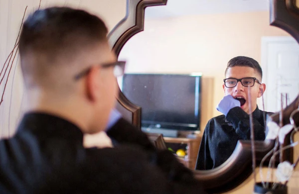 Bu şəxs xəstəliyi səbəbindən gülə bilmir