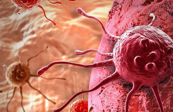 Xərçəng sahəsində mütəxəssis olan və dünya tərəfindən tanınmış adlar, xərçəngin yaxında soyuqdəymə kimi bir xə