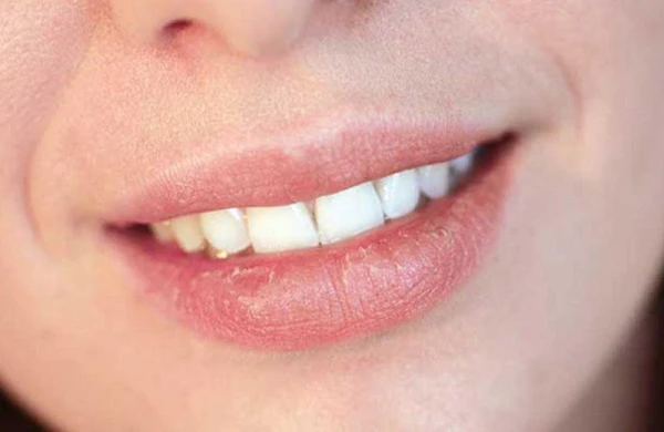 Ağzınız quruyursa... - 5 TƏHLÜKƏLİ SƏBƏB