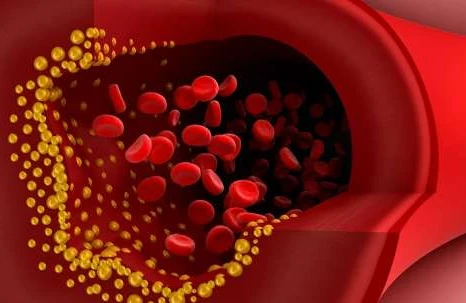 Damar tıxanmasına və insulta səbəb olan QİDALAR