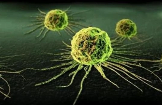 Xərçəngin qarşısını alan 3 QİDA