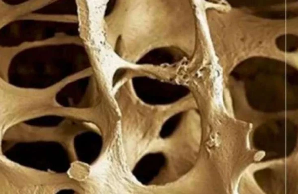 Sümüklərinizi vaxtından əvvəl məhv edən - 5 qida