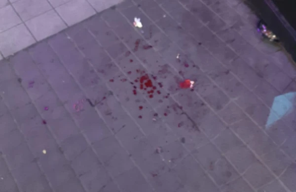 "Tarqovıy" da dəhşət: Gəncin üzünə lezva çəkdilər + FOTO