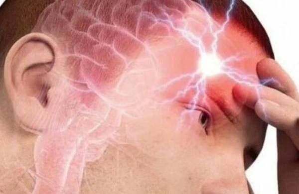 Kəskin miqren ağrılarına EV ŞƏRAİTİNDƏ SON