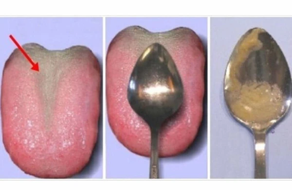 60 saniyəlik sağlamlıq testi: Sizə yalnız çay qaşığı lazım olacaq