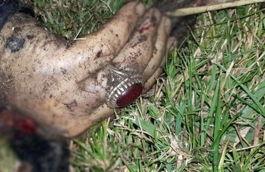 Generalın anbaan öldürüldüyü görüntü təkcə əli qalıb - VIDEO