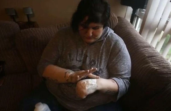 15 ildir uşaq pudrası yeyir - SƏBƏB