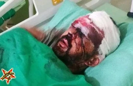 Azərbaycanlı müğənni qəzaya düşdü - QAN AXTARIRLAR