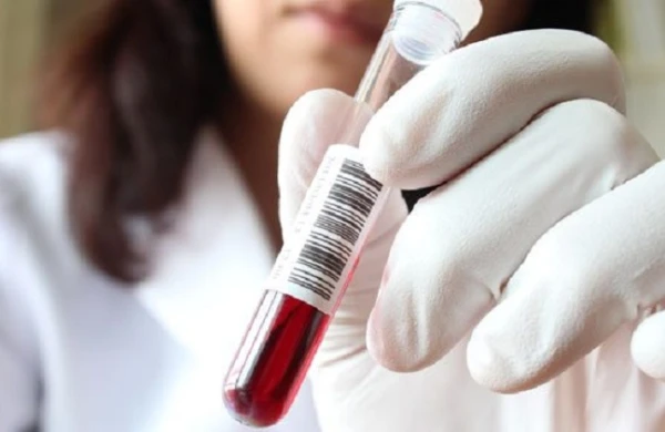 SON DƏQİQƏ! Səhiyyə Nazirliyi əhaliyə təcili müraciət edib: Qorxunc virus yayılıb