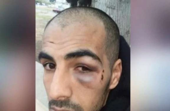 Göyçay toyunda kütləvi dava — Qıza nömrə verən ofisiant döyüldü (VİDEO)