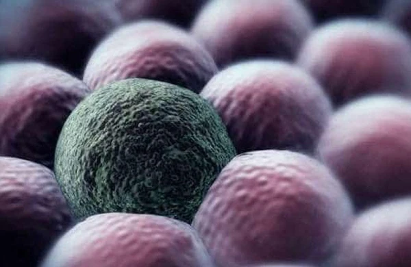 Alimlərdən şok araşdırma: xərçəng 1 saniyəyə məhv ediləcək