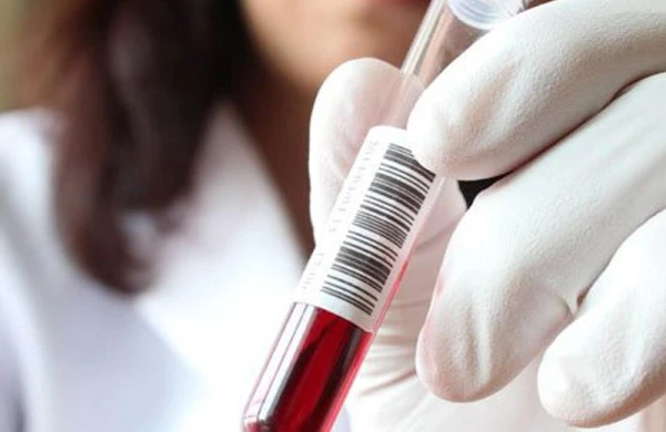 Almaniyada koronavirusa yoluxanların sayı 10 nəfərə çatıb