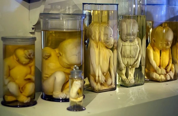 Yuxularınızı qaçıracaq — Dünyanın ən qorxulu 10 MUZEYİ