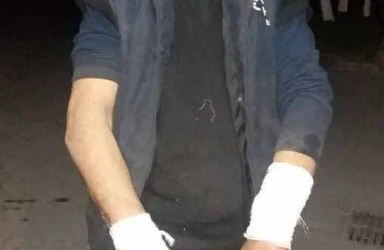 Bakıda canavar 54 yaşlı kişiyə hücum etdi - FOTO