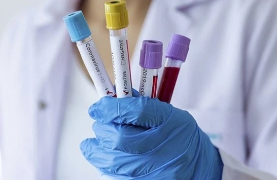 TƏHLÜKƏ: İranda virusdan ölənlərin sayı artır