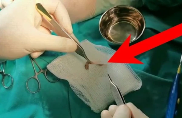 Azərbaycanda sünnət zamanı uşağın cinsiyyət orqanı kökündən kəsildi - ŞOK VİDEO