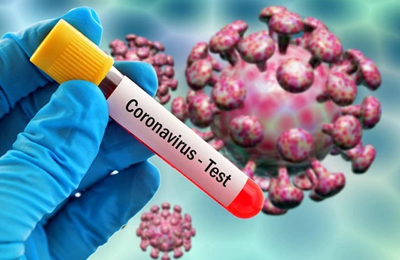 Azərbaycanda koronavirus aşkarlanan şəxsin 23 yaşı var