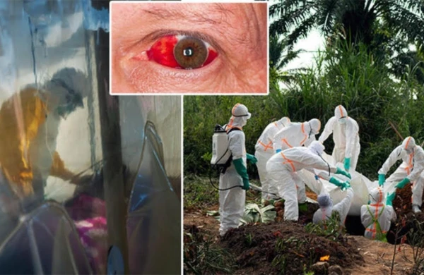 Dünya şokda! Koronovirusdan da dəhşətli yeni xəstəlik yayıldı 