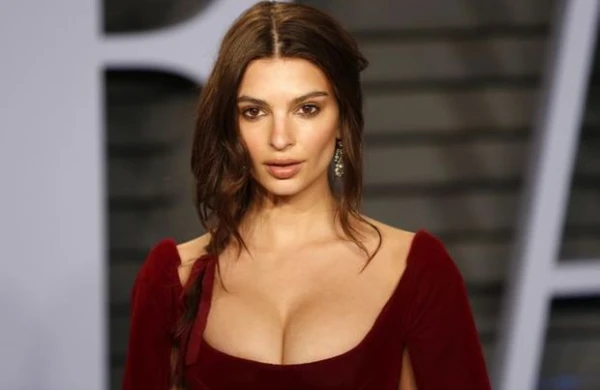 Cazibədar model yataqda iti ilə şəklini paylaşdı - FOTO