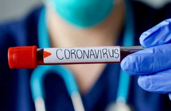 Daha iki azərbaycanlıda koronavirus aşkarlandı - Biri tələbədir