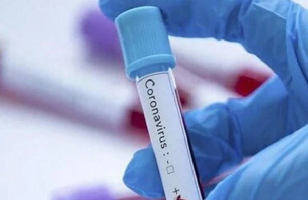 Azərbaycanda daha 2 nəfərdə koronavirus tapıldı