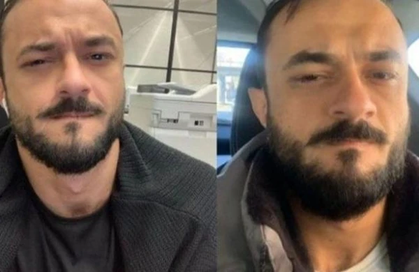 Koronavirusa yoluxan azərbaycanlı gənc: "Heç vaxt belə ağrı hiss etməmişəm"