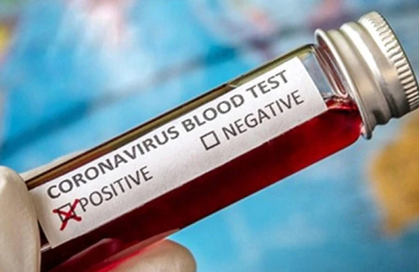Rus yazıçıdan sensasiya: Koronavirus yoxdur, məqsəd...