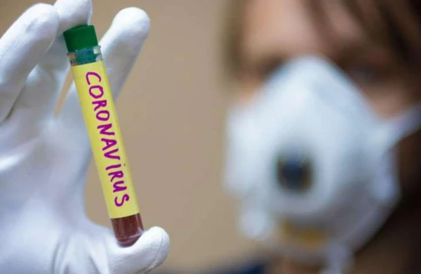 Koronavirusun DƏRMANI TAPILDI, apreldən etibarən... - YAPON ALİMLƏRDƏN ŞAD XƏBƏR