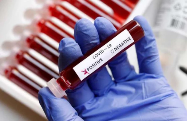 Çinin yardım üçün göndərdiyi testlərdə koronavirus aşkarlandı