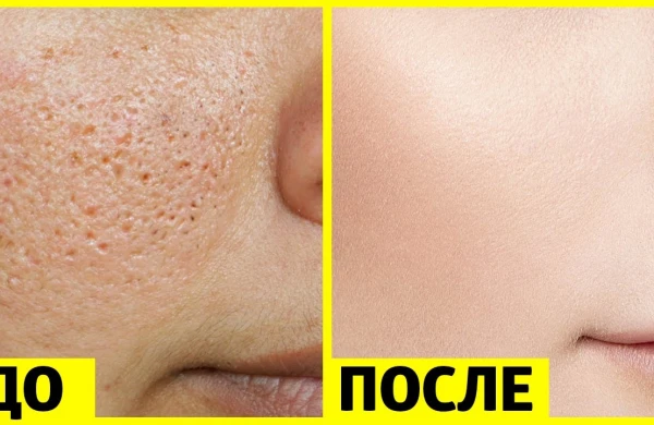 КАК ИЗБАВИТЬСЯ ОТ БОЛЬШИХ ПОР И ПОЛУЧИТЬ ГЛАДКУЮ КОЖУ ЗА НЕДЕЛЮ